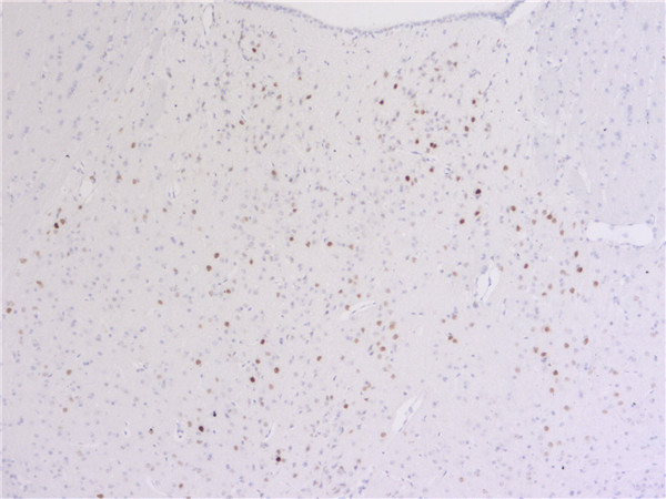 IHC-P：c-Fos (1:1000; DAB) 