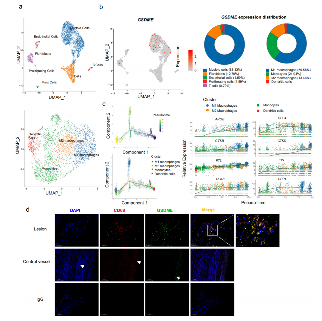 GSDME is mainly expressed in atherosclerotic macrophages..png