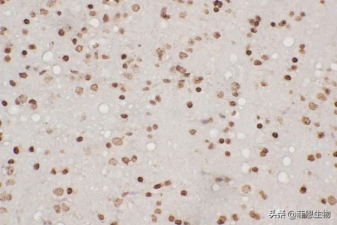 「技术分享」免疫组化基础（1）—如何标准化新免疫组化法