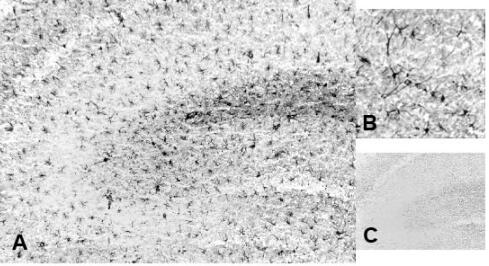 艾美捷GFAP抗体神经元示踪剂解决方案 艾美捷GFAP抗体神经元示踪剂解决方案