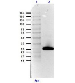 antibodies-online-链霉抗生物素蛋白（HRP）正在热销