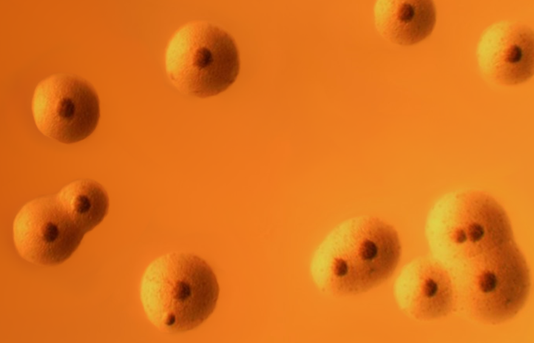 探秘黑胶虫（下）