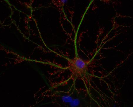 谷氨酸三方突触丨SYSY谷氨酸GluA解决方案 谷氨酸三方突触丨SYSY谷氨酸GluA解决方案