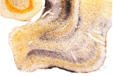 中英文说明书丨艾美捷FD NeuroSilver退化神经元银染试剂盒II 中英文说明书丨艾美捷FD NeuroSilver退化神经元银染试剂盒II