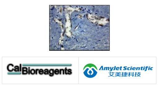 CalBioreagents/艾美捷 ID蛋白单克隆抗体案例分析   