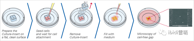 ibidi |笔直的划痕：从样品制备到图像分析只需四步