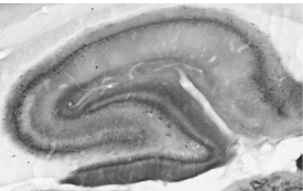 NeuroMab科研级抗Nav1.1钠通道抗体(K74/71)正在促销中 NeuroMab科研级抗Nav1.1钠通道抗体(K74/71)正在促销中