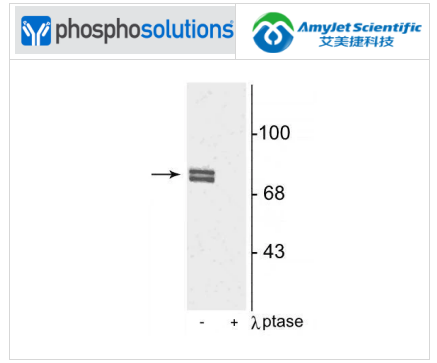 艾美捷Phosphosolutions抗 5-脂氧合酶 (Ser523) 抗体方案 艾美捷Phosphosolutions抗 5-脂氧合酶 (Ser523) 抗体方案