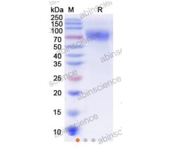 abinscience重组亨德拉病毒糖蛋白G蛋白,n-链球菌，限时折扣等你抢！