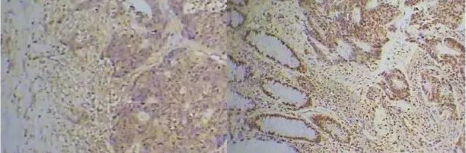 免疫组化：非特异性染色的八大原因