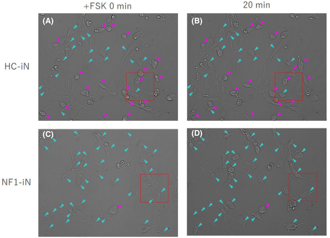 常见小分子抑制剂在疾病研究中的应用