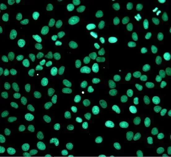 干货分享 | TUNEL法检测细胞凋亡原理和经验