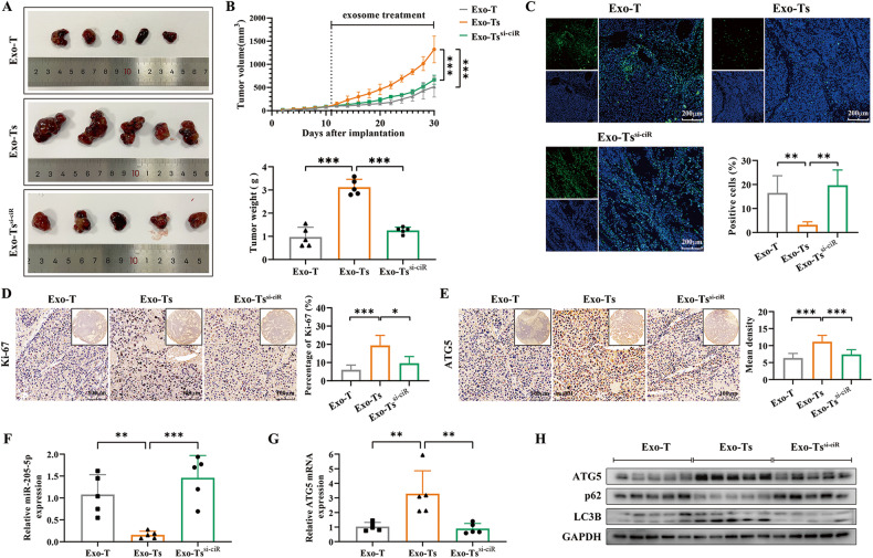 外泌体和细胞自噬