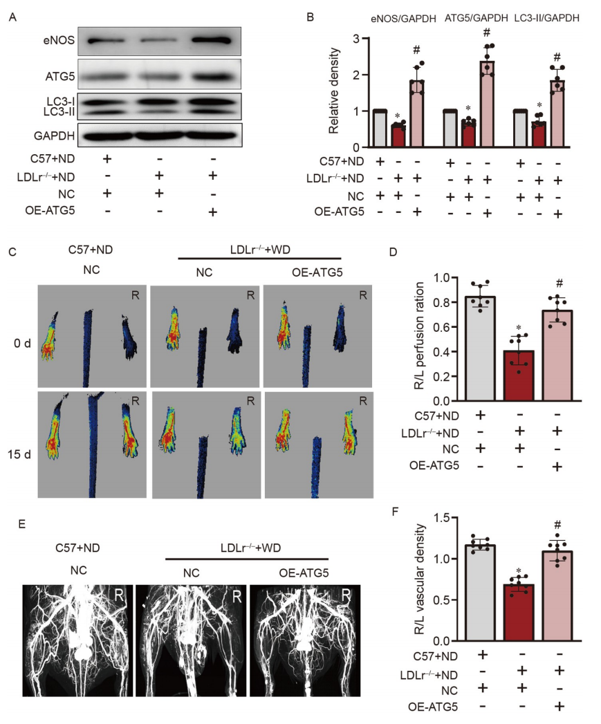 文献解读 | 高密度脂蛋白通过miR-181a-5p调控自噬影响血管新生