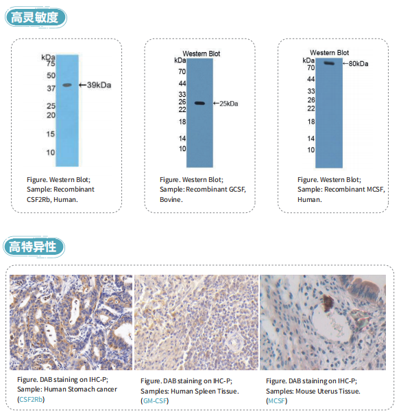 云克隆集落刺激因子类抗体