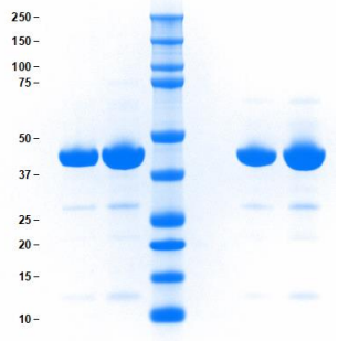 Athens-载脂蛋白AIV 狂欢季，限时促销大放价！