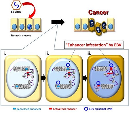 EBV相关胃癌的新模式