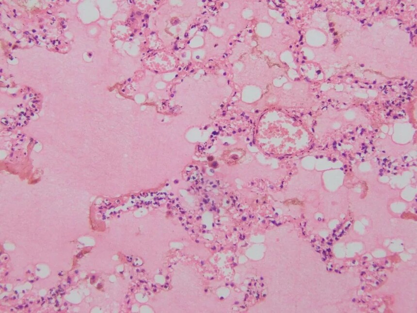 1693384215149338.jpg 1693384215149338.jpg