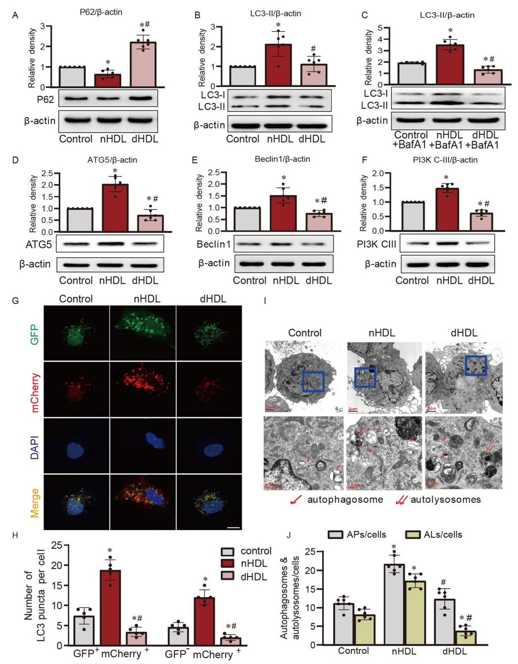 文献解读 | 高密度脂蛋白通过miR-181a-5p调控自噬影响血管新生