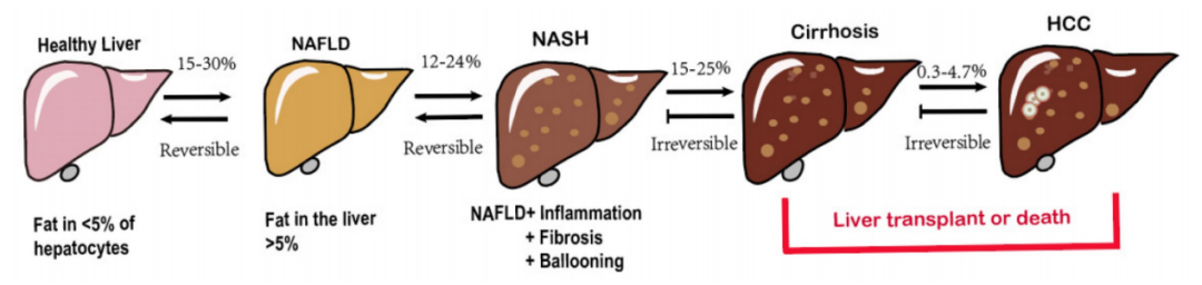 核受体：非酒精性脂肪性肝病的潜在治疗靶点