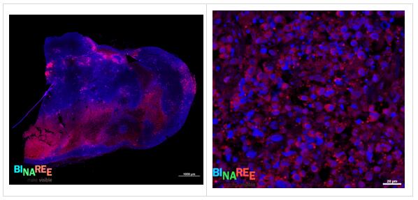 艾美捷IFN-gamma体内抗体免疫荧光实例展示 艾美捷IFN-gamma体内抗体免疫荧光实例展示