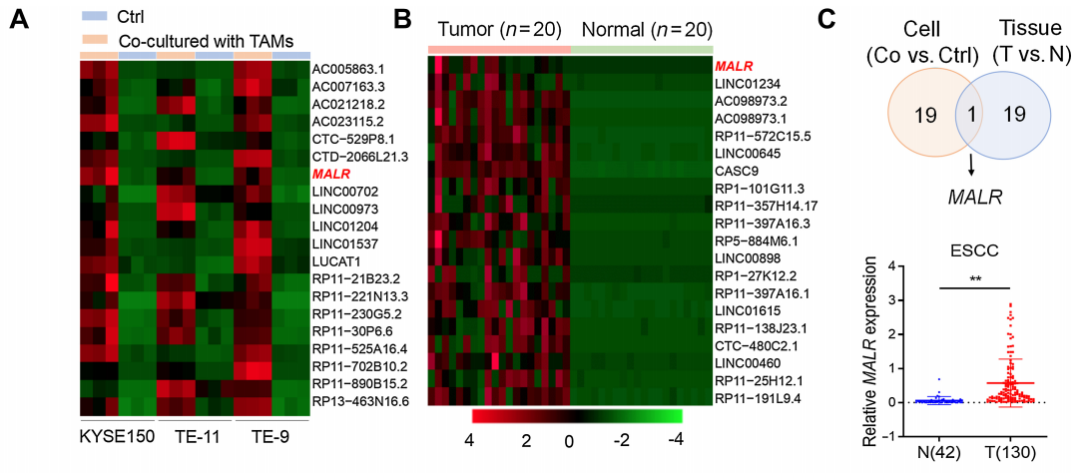 【客户文献解读,IF>11】食管癌的