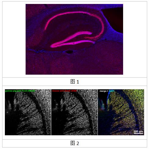 NeuN抗体丨SYSY NeuN抗体的应用及实例展示