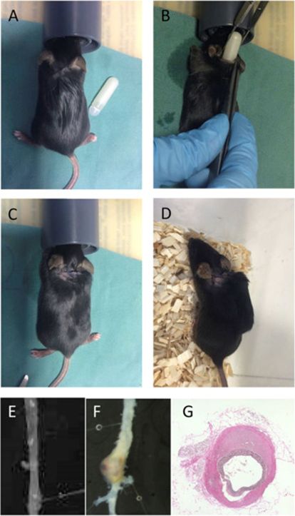 技术干货 | 血管紧张素II诱导腹主动脉瘤模型概述