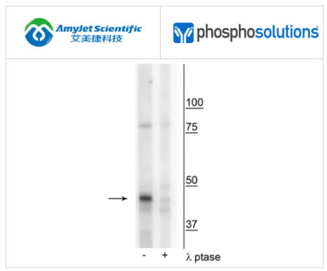 PhosphoSolutions抗CK1Mt（Tyr153）抗体解决方案