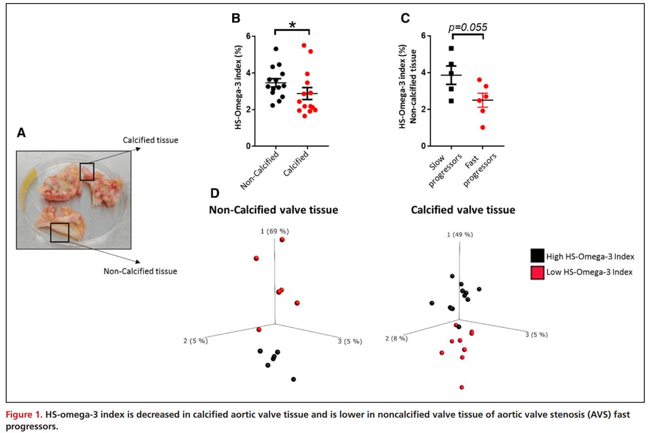 Circulation | n-3 PUFAs通过RvE1/ChemR23轴减少主动脉瓣狭窄