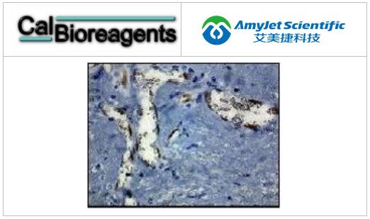 CalBioreagents 人α1微球蛋白抗原中英文说明书