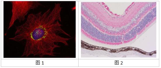 α微管蛋白研究丨SYSY α微管蛋白抗体案例分析 α微管蛋白研究丨SYSY α微管蛋白抗体案例分析