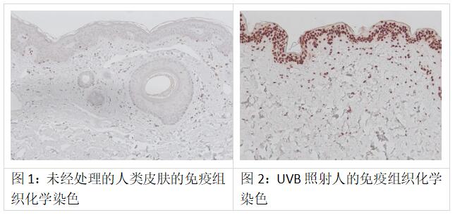 Kamiya艾美捷环丁丨烷嘧啶二聚体CPD相关说明