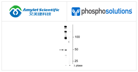 PhosphoSolutions抗eEF1A2(Ser358)抗体解决方案 PhosphoSolutions抗eEF1A2(Ser358)抗体解决方案