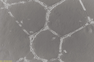 简单,可靠,艾美捷内皮血管生成检测试剂盒相关研究 简单,可靠,艾美捷内皮血管生成检测试剂盒相关研究