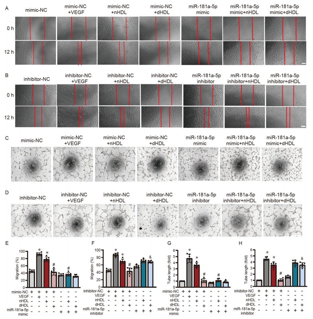 文献解读 | 高密度脂蛋白通过miR-181a-5p调控自噬影响血管新生