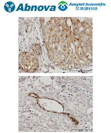 Abnova丨艾美捷抗GBA单克隆抗体解决方案 Abnova丨艾美捷抗GBA单克隆抗体解决方案
