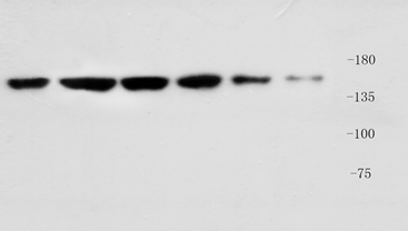 低丰度蛋白来挑战我们极敏型ECL发光液吧 ！