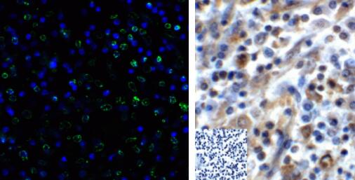 ProSci丨艾美捷 TIGIT抗体——慢性病毒研究帮手 ProSci丨艾美捷 TIGIT抗体——慢性病毒研究帮手