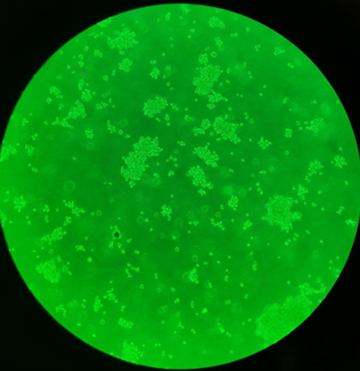 1637891567639164.jpg 严重聚团的THP-1细胞