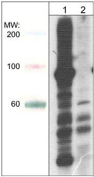 通用型磷酸化苏氨酸抗体丨ECM Biosciences案例分析