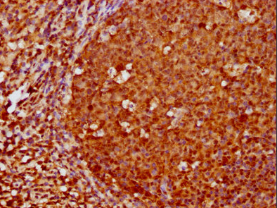 Epigentek-FOXO3重组单克隆抗体[1E2]，超值优惠大放送