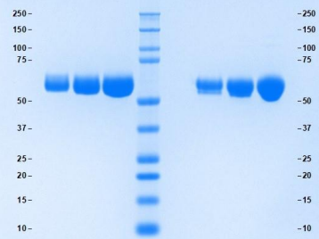 Athens-α1抗胰凝乳蛋白酶，限时促销来袭！