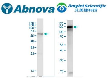 艾美捷Abnova ACTN4纯化兔多克隆抗体说明书