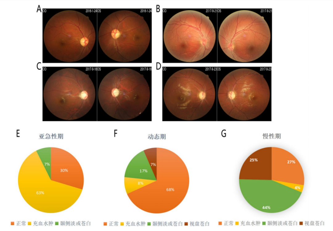 Leber遗传性视神经病变