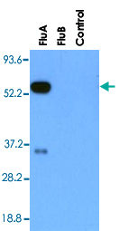 甲型流感病毒核蛋白单克隆抗体说明书   