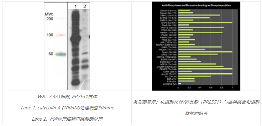 不踩雷，就用ECM Biosciences通用磷酸化丝氨酸抗体