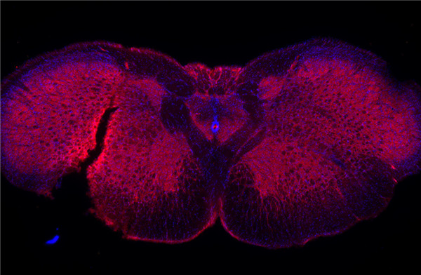 Glycine receptor alpha 1