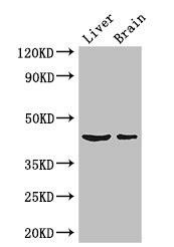 Epigentek-METTL2A多克隆抗体限时促销，不要错过！
