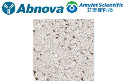 Abnova ABCA3多克隆抗体说明书（附应用实例）